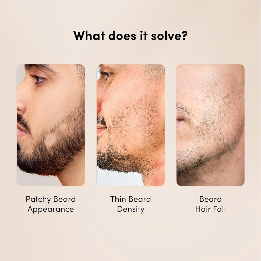 VELRÉN Beard Oil – Premium Nourishing & Conditioning Beard Oil (50ml)