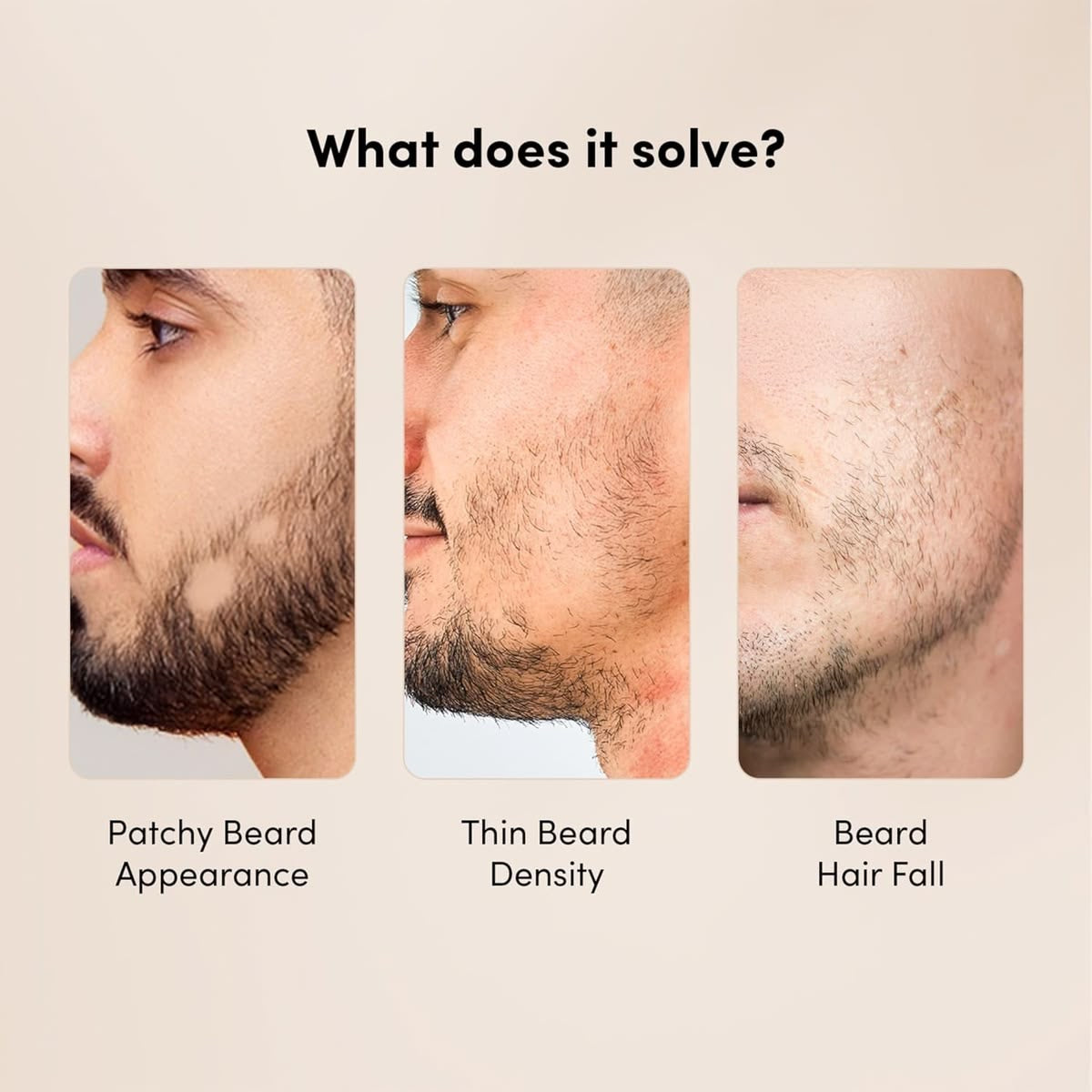 VELRÉN Beard Oil – Premium Nourishing & Conditioning Beard Oil (50ml)
